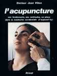 L'acupuncture
